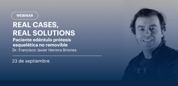 Real Cases, real solutions. Paciente edéntulo prótesis esquelética